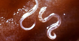 blastocystis hominis paraziti nedir