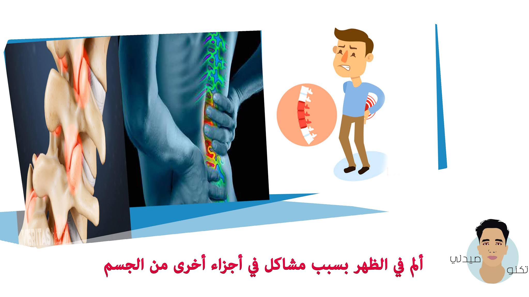 ألم في الظهر بسبب مشاكل في أجزاء أخرى من الجسم ألم في الظهر بسبب مشاكل في أجزاء أخرى من الجسم