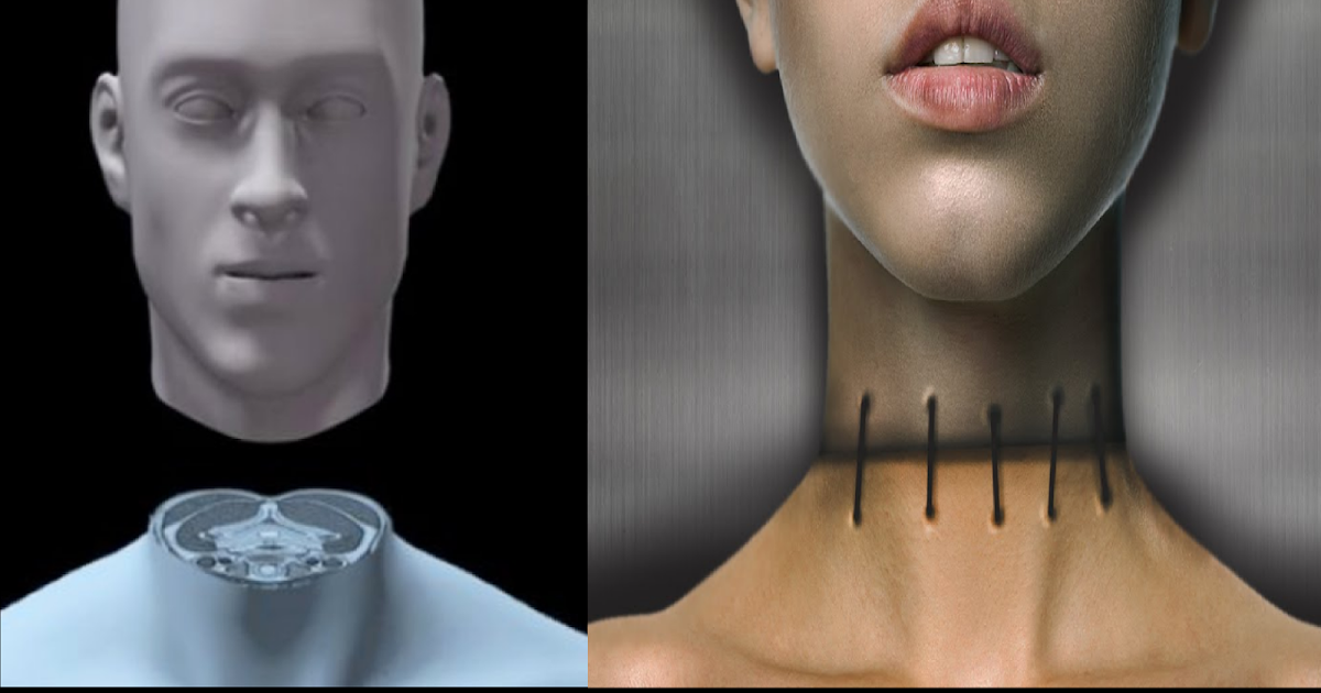 Is It possible To Transplant A Human Head? Majestic Fact