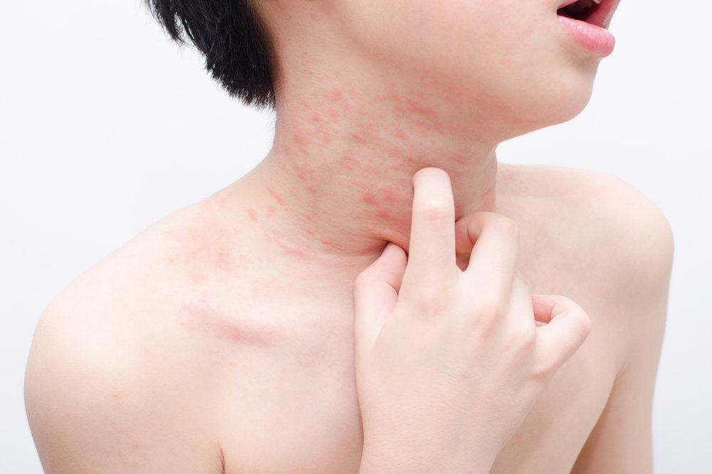 mengurangi gejala-gejala masalah kulit