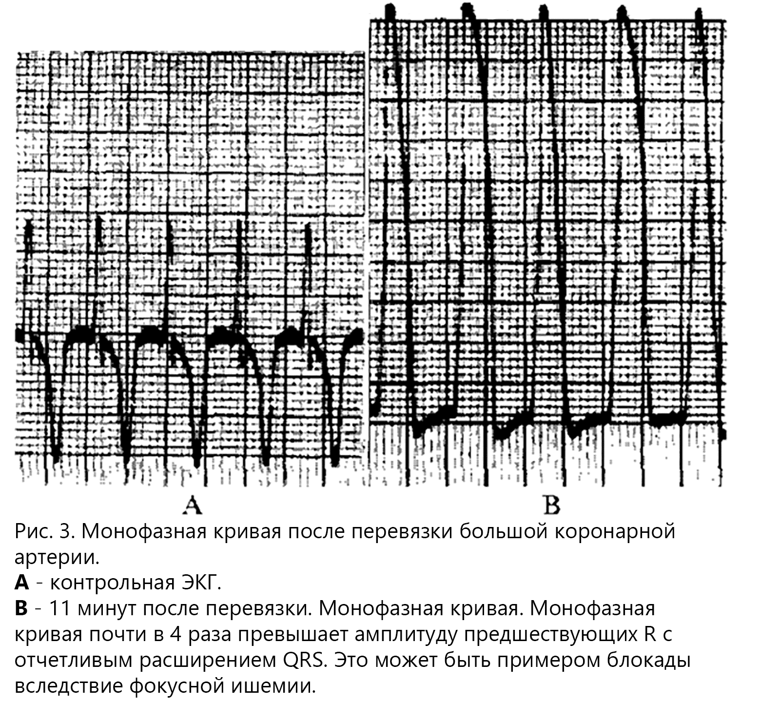 Все займы по ставке от 0% денежным переводом в МФО Вырицы, заявка через интернет