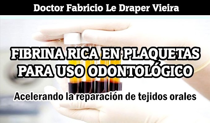 WEBINAR: FIBRINA RICA EN PLAQUETAS EN ODONTOLOGÍA: Acelerando la reparación de tejidos orales - Dr. Le Draper