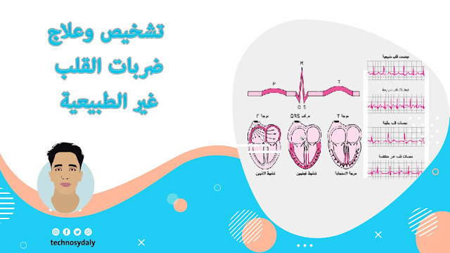 تشخيص وعلاج ضربات القلب غير الطبيعية تشخيص وعلاج ضربات القلب غير الطبيعية