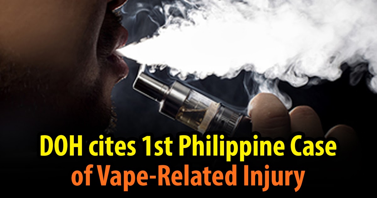 DOH announces 1st Philippine Case of VapeRelated Injury The Most