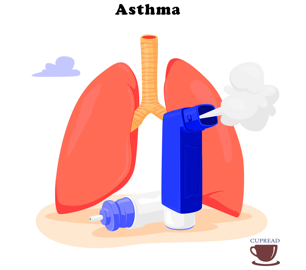 asthma