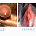 Ini cara alami obat kencing nanah thumbnail