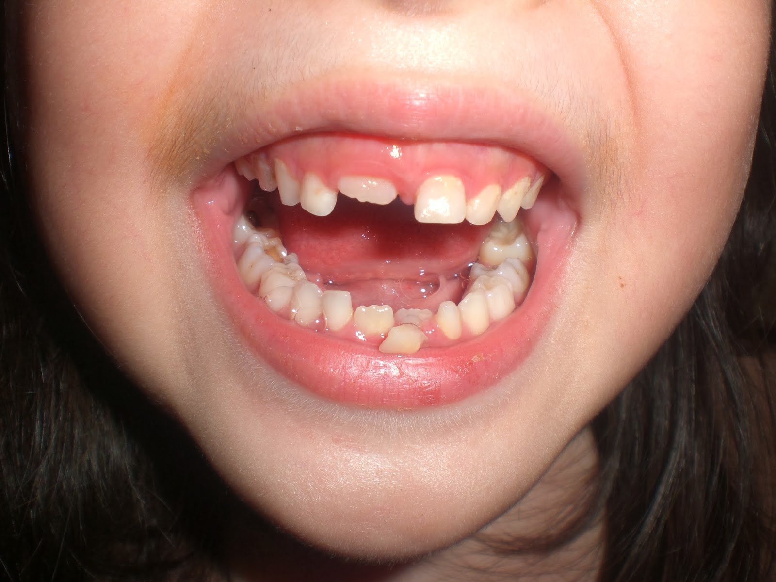 Bundle Of Joy First Years Move On Milk Teeth