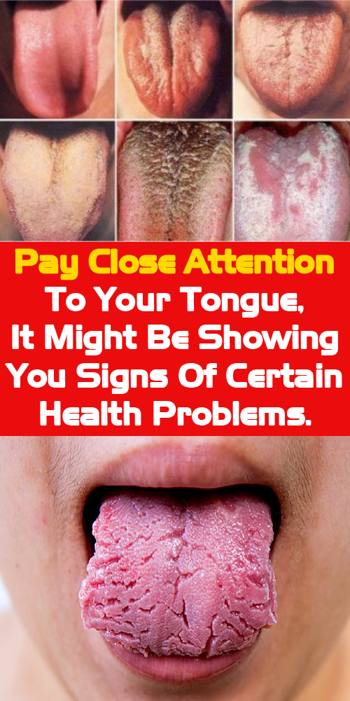 Pay Close Attention To Your Tongue It Might Be Showing You Signs Of
