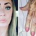 Woman Works In Nursing Home, Snaps Picture Of Resident’s Hand That’s Going Viral
