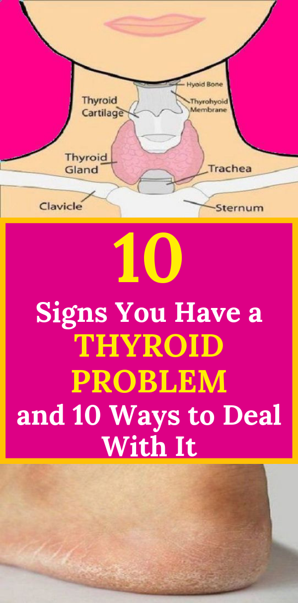 10 Signs You Have a Thyroid Problem and 10 Ways to Deal With It