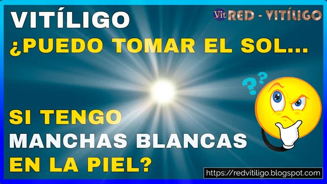 Vitiligo, ¿es bueno tomar el sol para las manchas blancas?