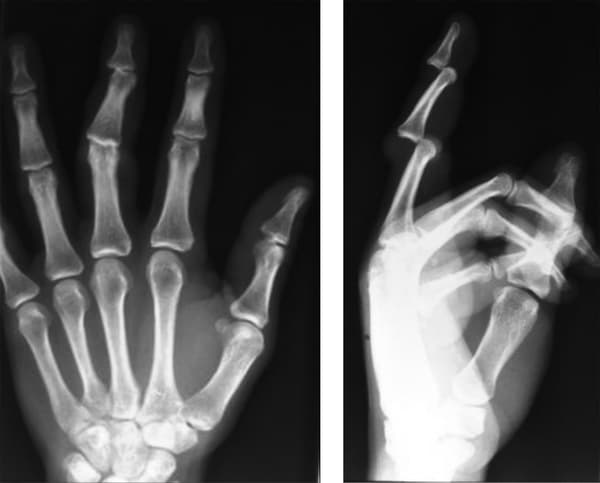 18 Radiographs that help you know the body as much as a book of anatomy