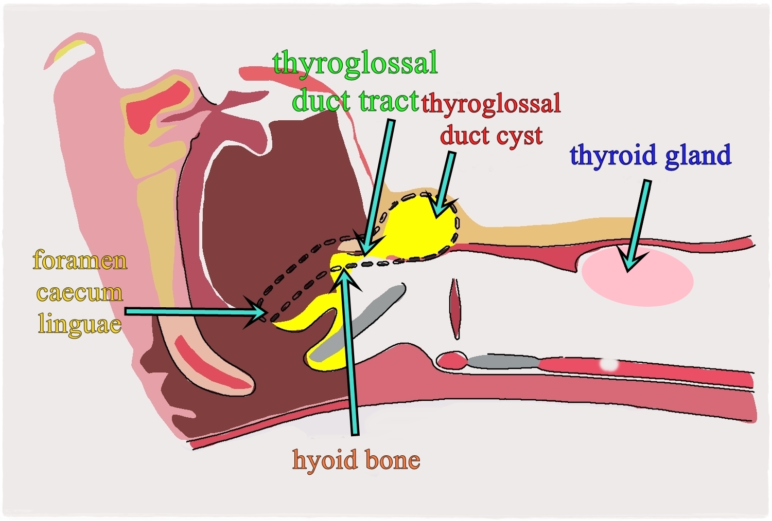 Thyroglossal Duct Cyst Anatomy