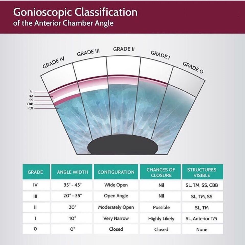 Ophthalmology Notes Shaffer system Gonioscopy