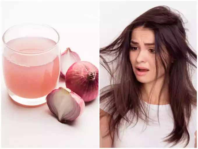 6 Side Effects of Onion Juice on Hair in Hindi