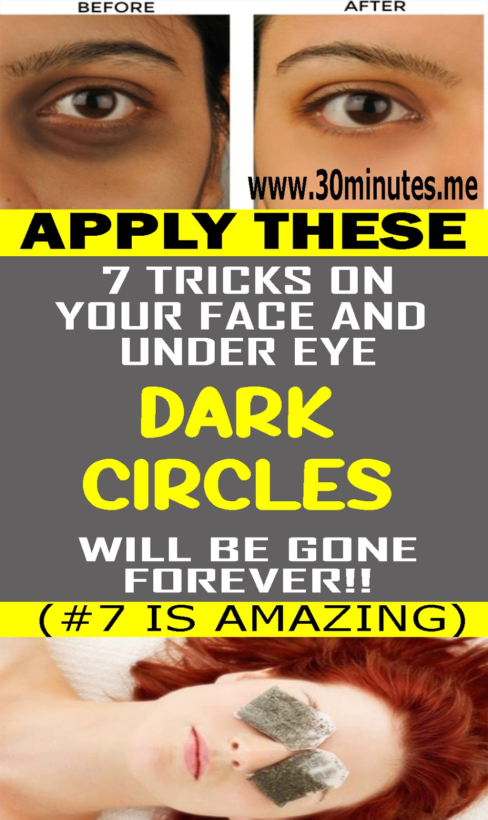 7 Remedies How To Remove Under Eye Dark Circles HEALTH and WELLNESS