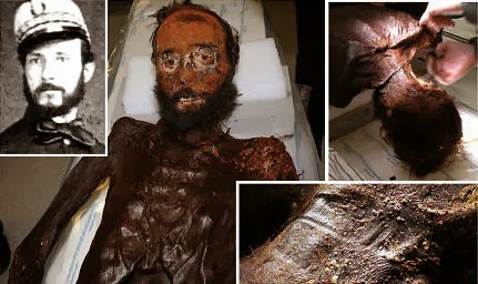 Momificación de Juan Prim y Prats