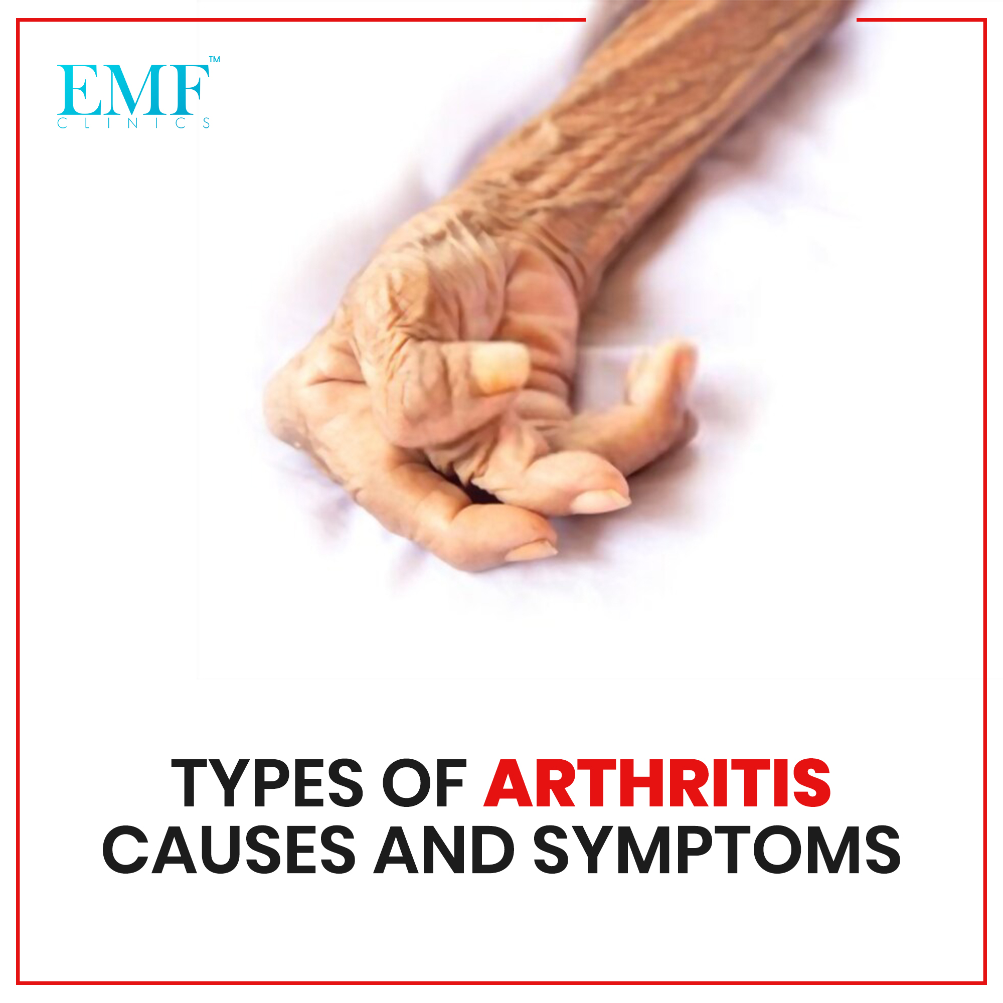 Types Of Arthritis Causes and Symptoms EMF Clinics