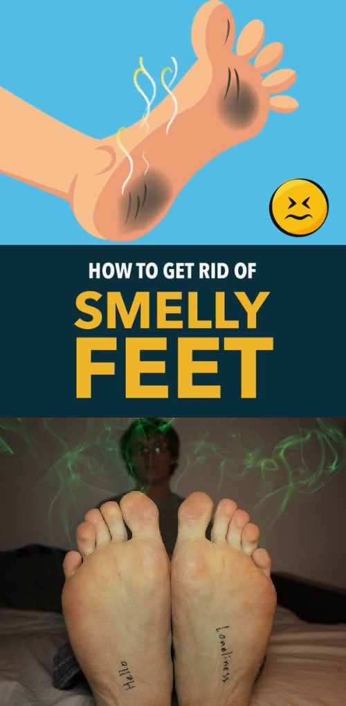 How to Get Rid of Very Smelly Feet? Beautypro Club