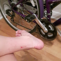 Jambe, blessure superficielle, vélo, salon