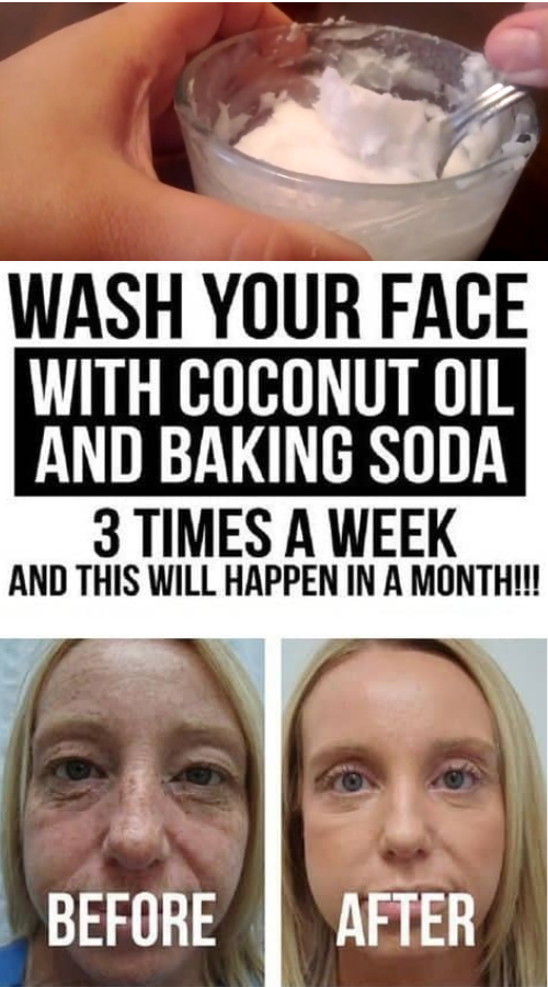Heatlh is happy Wash Your Face with Coconut Oil and Baking Soda 3 Times a Week and This Will