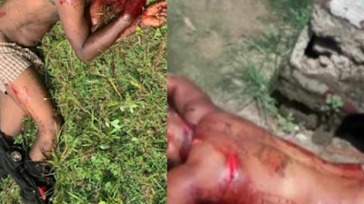 Bloodbath In Ikorodu As Eiye And Aye Confraternity Clash (Viewers Discretion) 