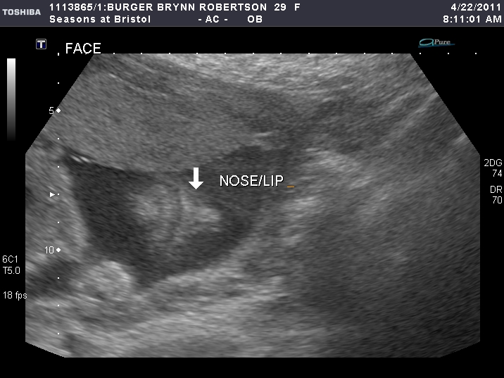 Family Pack of Burgers April 2011