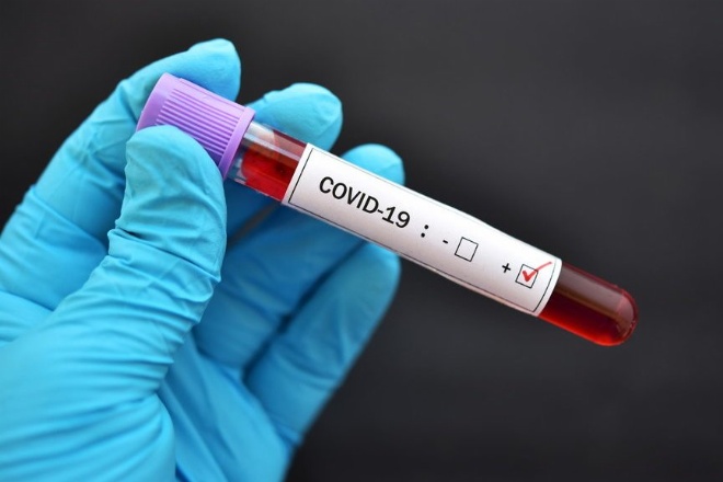 Positif Covid-19 di Bone Bertambah 3 Kasus