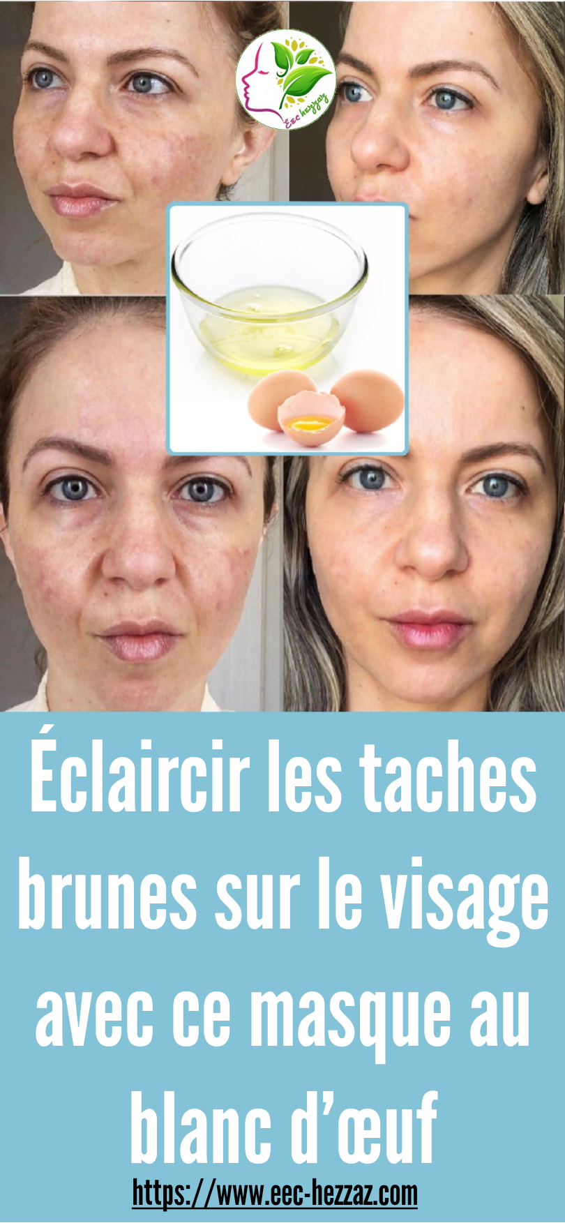 Éclaircir les taches brunes sur le visage avec ce masque au blanc d’œuf