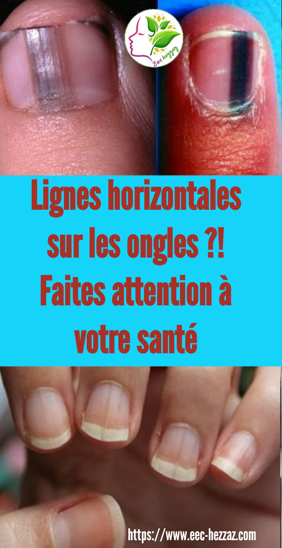 Lignes horizontales sur les ongles ?! Faites attention à votre santé