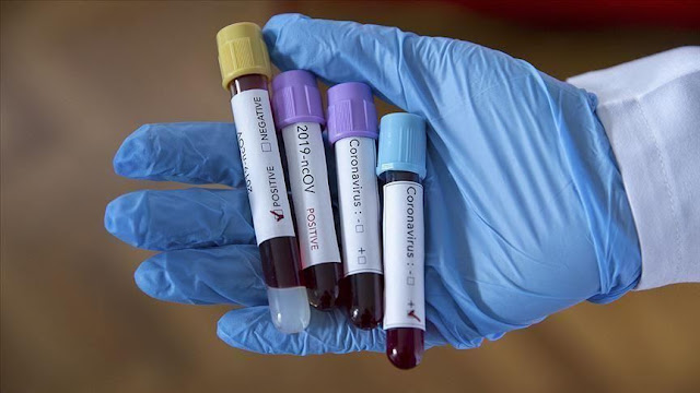 المهدية : تسجيل 22 إصابة جديدة بفيروس كورونا