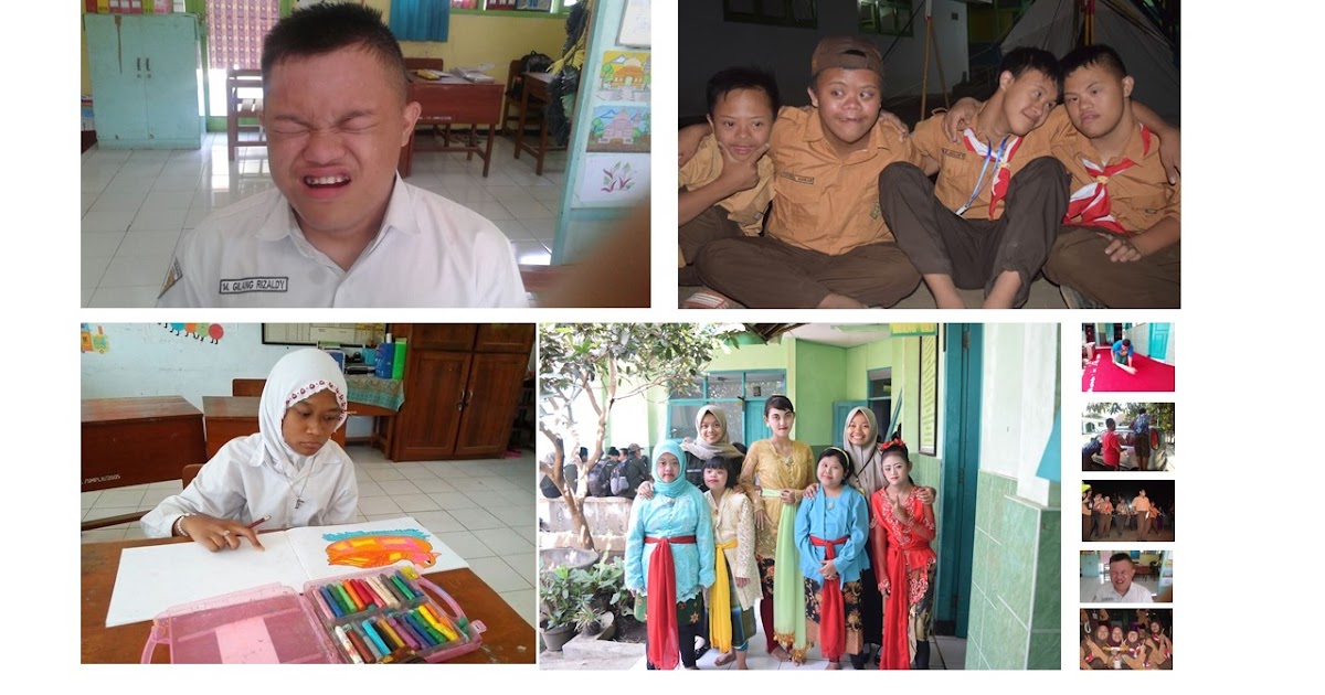 Anak Berkebutuhan Khusus dan Jenis-Jenisnya