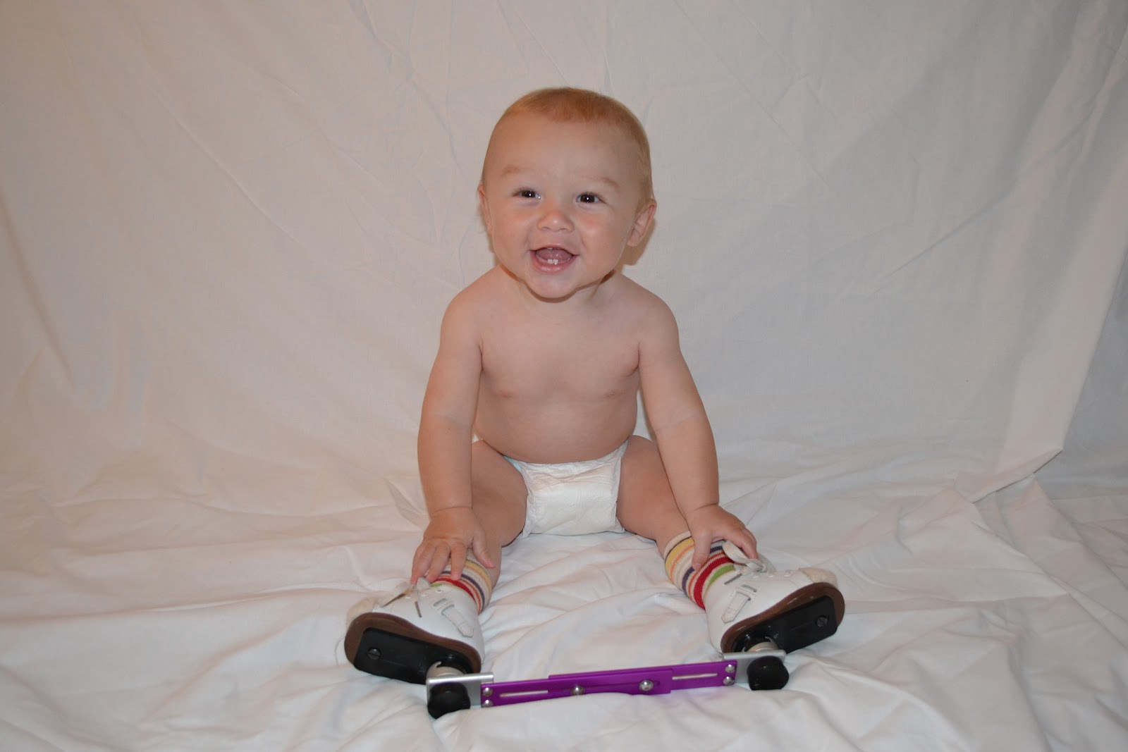 BusyBee UK Crafty, Talipes, Baby and Lifestyle Blog Yes my child is different