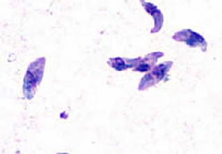 Toxoplasma gondii pod mikroskopom Panvet