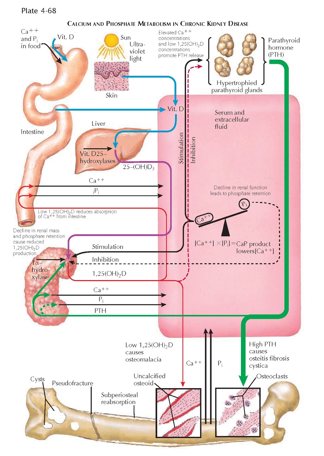 OVERVIEW OF CHRONIC KIDNEY DISEASE pediagenosis