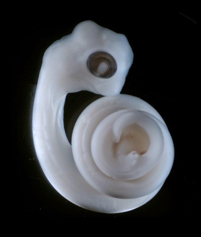 Genesis of genitalia Genesis of genitalia