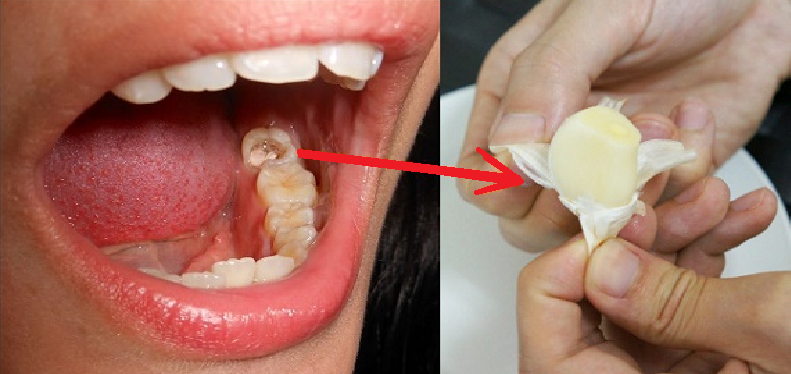 Bawang putih