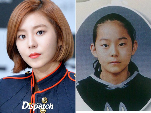 Dispatch's list of 8 idols who admitted to plastic surgery.