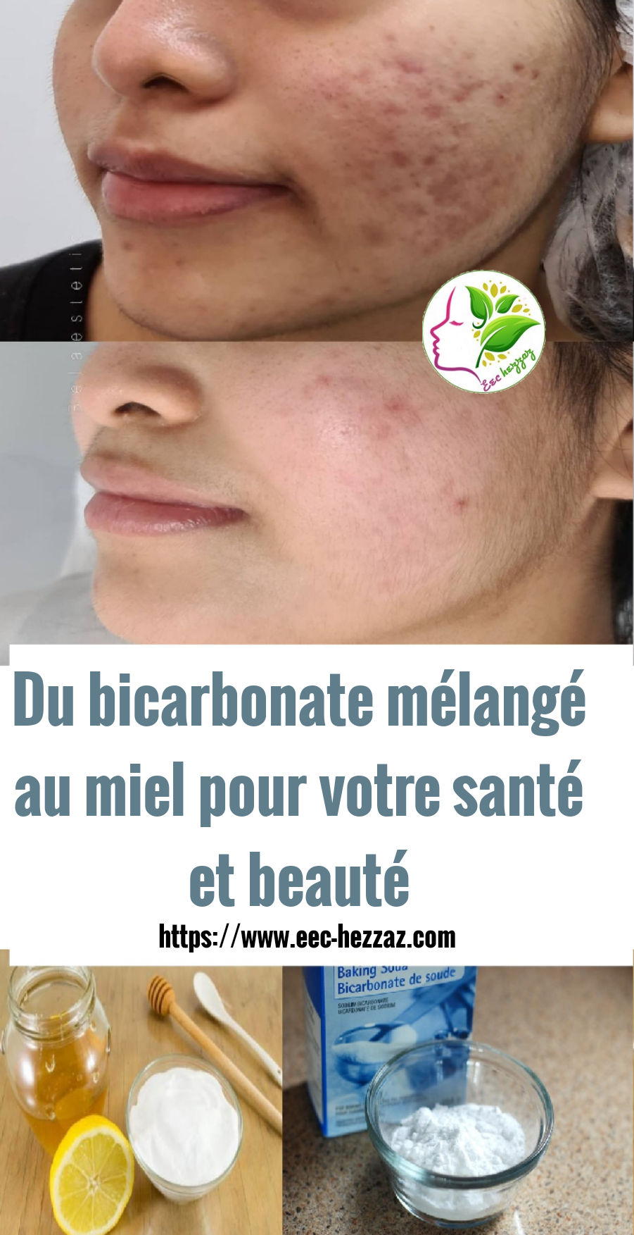 Du bicarbonate mélangé au miel pour votre santé et beauté