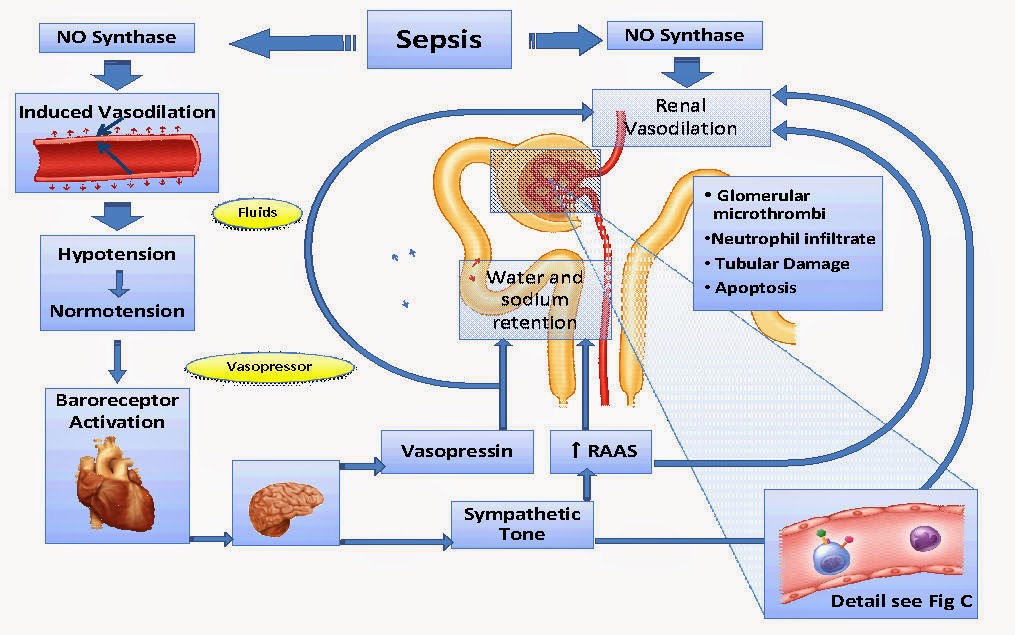 The Health site Sepsis