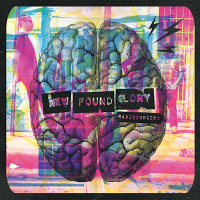 New Found Glory, Radiosurgery, Anthem for the Unwanted, Summer Fling Don't Mean a Thing, Caught in the Act, Drill it in My Brain, Memories and Battlescars, Map of Your Body