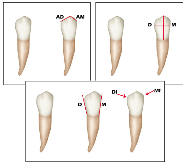 Aula de Anatomia Dental Anatomia do Canino Inferior Dente 33 e Dente 43 Aula de Anatomia Dental Anatomia do Canino Inferior Dente 33 e Dente 43