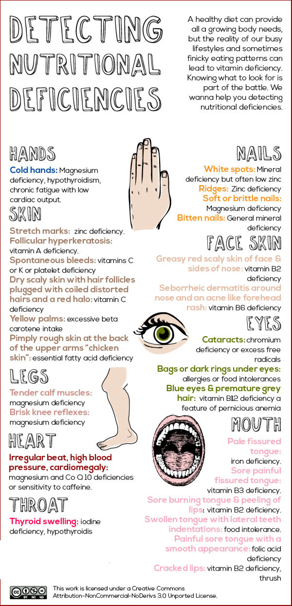 American Teens Are Vitamin Deficient 48