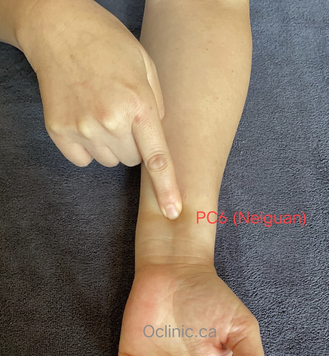 Acupuncture Massage Clinic Scarborough 2 Acupuncture Points for