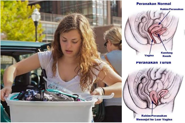 Alasan Wanita Dilarang Angkat Berat, Salah Satunya Dapat Meyebabkan Peranakan Turun
