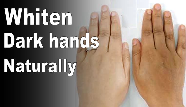 Hand whitening treatment tips at home