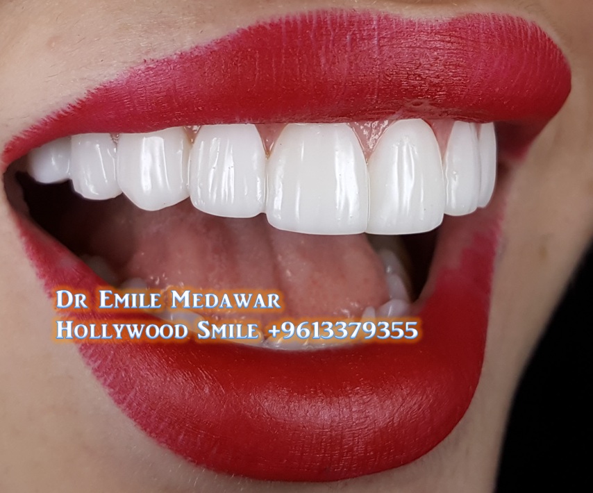 Cosmetic Dentist, Dr Emile Medawar, Beirut Lebanon, 00 961 3 379355