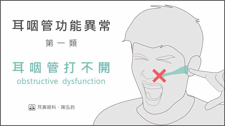 感冒後耳朵悶悶的-比您想像更常見的耳咽管功能異常- 照護線上 感冒後耳朵悶悶的-比您想像更常見的耳咽管功能異常- 照護線上