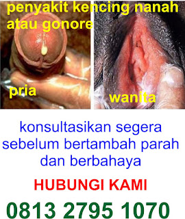 Obat Kencing Nanah Pria Wanita yang paling Manjur