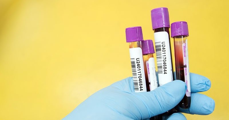 Harga Ujian Darah Di Klinik Swasta - voolexs